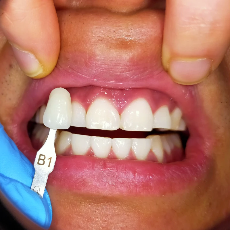 Auckland Your New North Shore Dentist